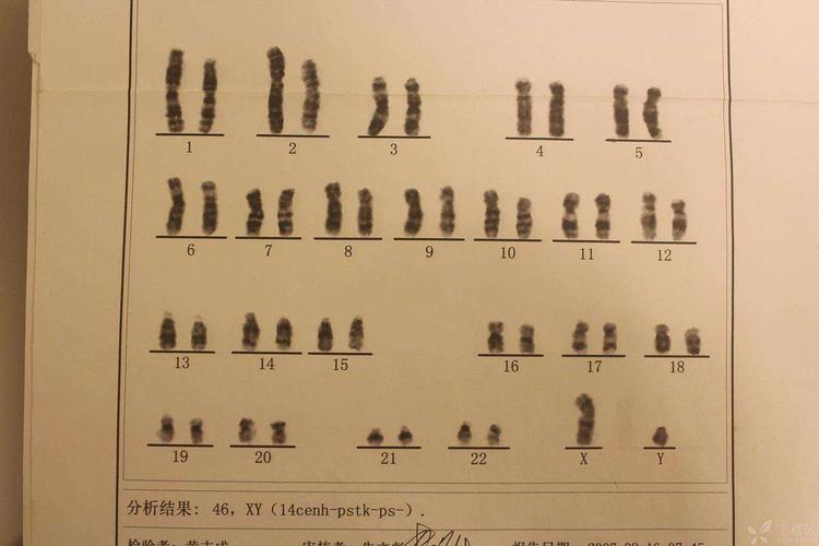 揭秘Sex Syndrome:全面解读各种性染色体异常综合征